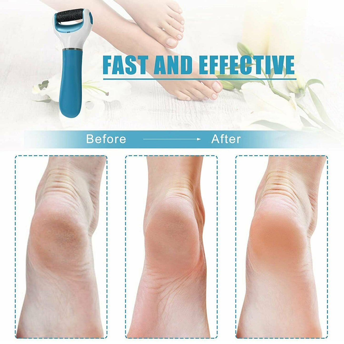 Electronic Dry Foot File Callous Remover For Feet Electric Foot With Roller Hard And Dead Skin- Regular Coarse Baby Smooth Feet In Minutes. For In Home Padicure Foot Care Battery Powered Usb (Battry Not Included)